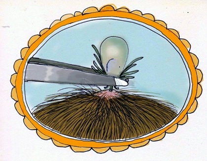 Custom image