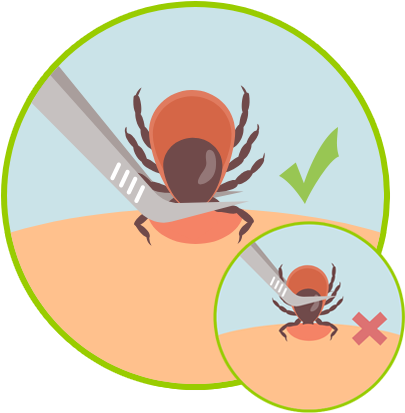 tick removal step 2
